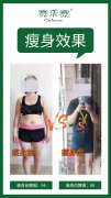 高龄产妇服用赛乐赛减肥药4个月成功减重32斤